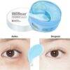 Z94841 - MASCARILLA PARA LOS OJOS CON ACIDO HIALURONICO x "SIAYZU" (1 PZA)